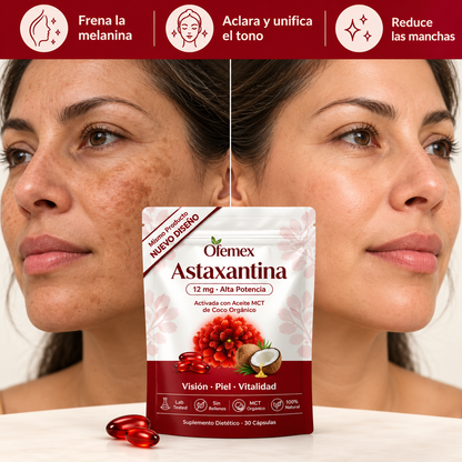 Astaxantina 12mg – El Antioxidante Más Potente para Todo tu Cuerpo