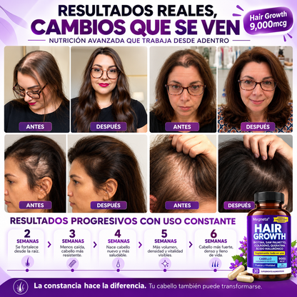 Hair Growth – Suplemento Anticaída con Biotina, Colágeno y Zinc